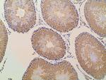 Ephrin B2 Antibody in Immunohistochemistry (Paraffin) (IHC (P))