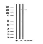 ZFYVE9 Antibody in Western Blot (WB)