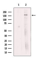 ZFYVE9 Antibody in Western Blot (WB)