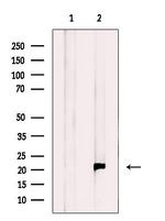 RT28 Antibody in Western Blot (WB)