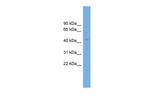 AS3MT Antibody in Western Blot (WB)