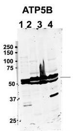 ATP Synthase beta Antibody in Western Blot (WB)