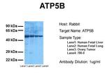 ATP Synthase beta Antibody in Western Blot (WB)