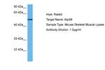 ATP Synthase beta Antibody in Western Blot (WB)