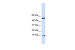 ATPIF1 Antibody in Western Blot (WB)