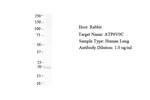 ATP6V0C Antibody in Western Blot (WB)