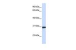 BarX2 Antibody in Western Blot (WB)