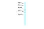 FOXA3 Antibody in Western Blot (WB)