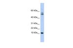 Myotrophin Antibody in Western Blot (WB)