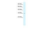 PSMD14 Antibody in Western Blot (WB)