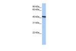 ACTR1B Antibody in Western Blot (WB)