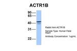 ACTR1B Antibody in Western Blot (WB)