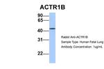 ACTR1B Antibody in Western Blot (WB)