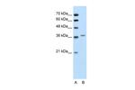 ALAD Antibody in Western Blot (WB)