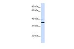 B3GALT1 Antibody in Western Blot (WB)