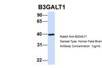 B3GALT1 Antibody in Western Blot (WB)