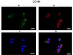 CD151 Antibody in Immunohistochemistry (IHC)