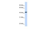 CLN8 Antibody in Western Blot (WB)