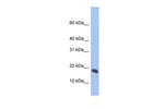 GMFG Antibody in Western Blot (WB)