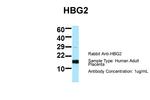 HBG2 Antibody in Western Blot (WB)