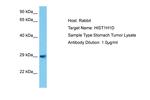 Histone H1.3 Antibody in Western Blot (WB)