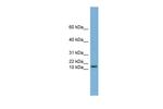 HRK Antibody in Western Blot (WB)