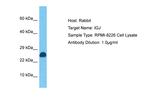 J Chain Antibody in Western Blot (WB)