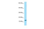 ORMDL3 Antibody in Western Blot (WB)