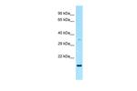 RAP2A Antibody in Western Blot (WB)