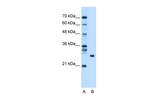 RBPMS Antibody in Western Blot (WB)