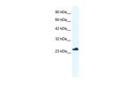 RTRAF Antibody in Western Blot (WB)