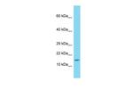 SAA Antibody in Western Blot (WB)