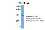 ST3GAL4 Antibody in Western Blot (WB)