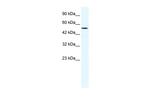 SUV39H1 Antibody in Western Blot (WB)