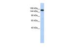 Synaptojanin 1 Antibody in Western Blot (WB)