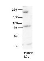 Synaptojanin 1 Antibody in Western Blot (WB)