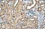 TBX15 Antibody in Immunohistochemistry (IHC)