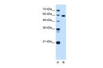 TBX15 Antibody in Western Blot (WB)