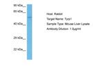 TYRP1 Antibody in Western Blot (WB)