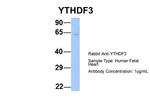 YTHDF3 Antibody in Western Blot (WB)