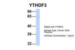 YTHDF3 Antibody in Western Blot (WB)