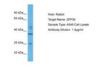 ZFP36 Antibody in Western Blot (WB)