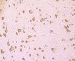 LOX-1 Antibody in Immunohistochemistry (Paraffin) (IHC (P))