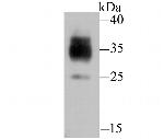 LOX-1 Antibody in Western Blot (WB)