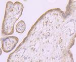 SCN9A Antibody in Immunohistochemistry (Paraffin) (IHC (P))