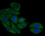 AMACR Antibody in Immunocytochemistry (ICC/IF)