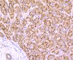 AMACR Antibody in Immunohistochemistry (Paraffin) (IHC (P))