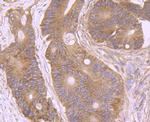 AMACR Antibody in Immunohistochemistry (Paraffin) (IHC (P))