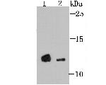 4EBP1 Antibody in Western Blot (WB)