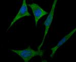 ULK1 Antibody in Immunocytochemistry (ICC/IF)